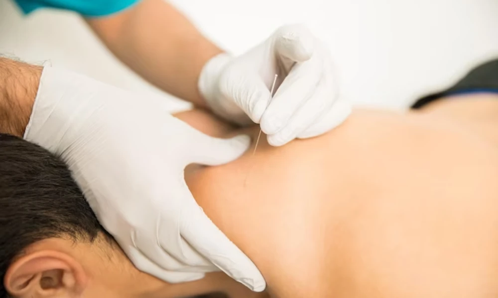 Pain-Free Living Awaits: Your Guide to Acupuncture Clinic Dubai
